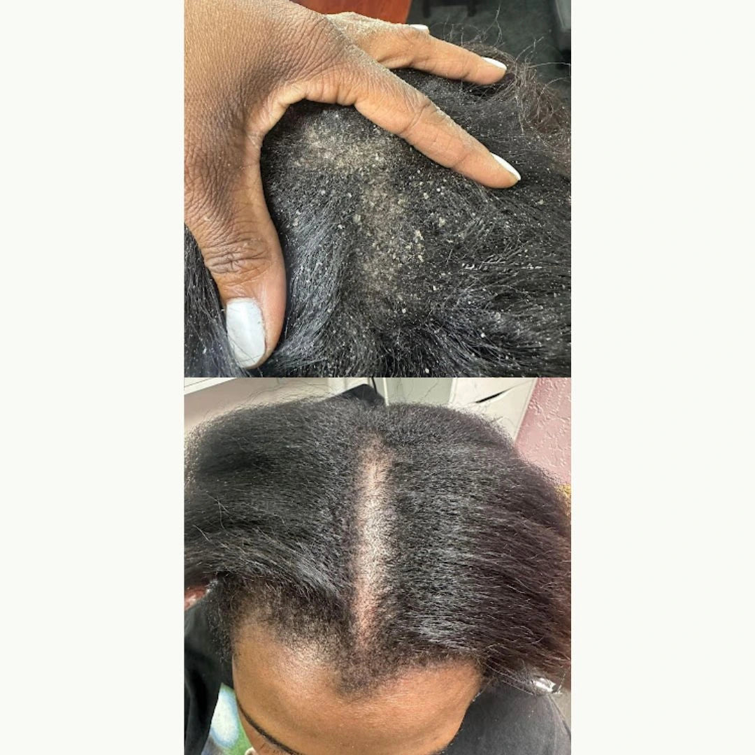 Ginger Shampoo Dermika